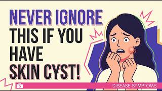 Skin Cysts Explained: What They Are & When To See A Doctor