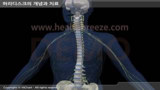 [시연용] a0030aako 허리디스크의 개념과 치료