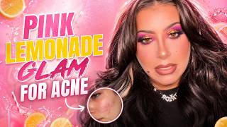 Pink Lemonade Eye's and Full Coverage Makeup for my Acne girlies | #acnemakeup #makeuptutorial