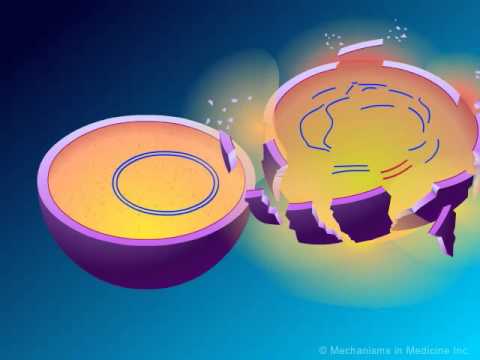 ß-lactams:-mechanisms-of-action-and-resistance