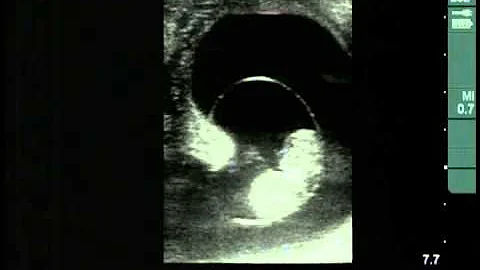 Cow #4539 Day 48 of Gestation