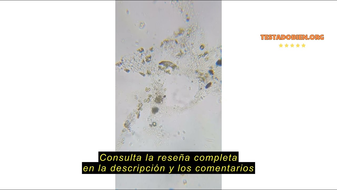 Reseña del SOLOMARK Adaptador de Lente de microscopio, Adaptador de cámara de teléfono Inteligente d