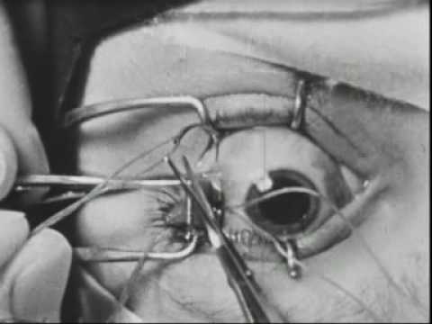 Todd Parker tucking operation (1932)
