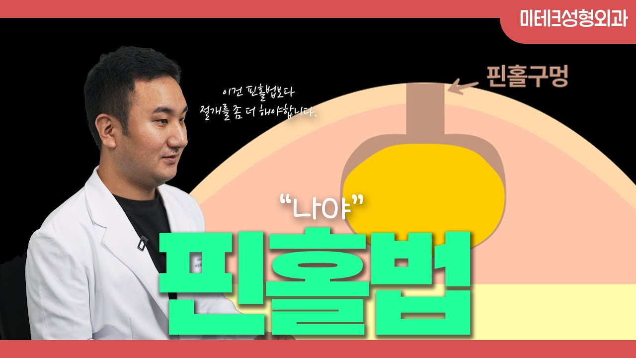 피지낭종 수술은 무조건 핀홀법으로?
