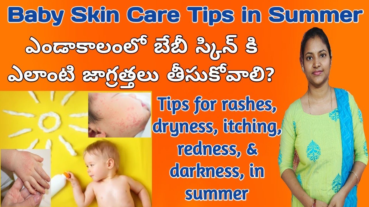 Skin care tips for babies in summer Baby skin care tips in summer summer care tips YouTube