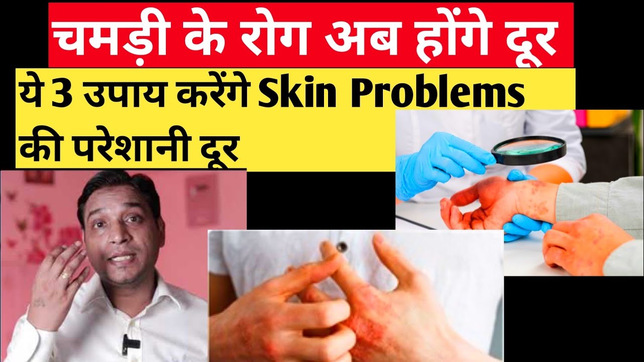 चमड़ी के रोग के कारण और उपाय | Factors Behind Skin Problems With Effective 