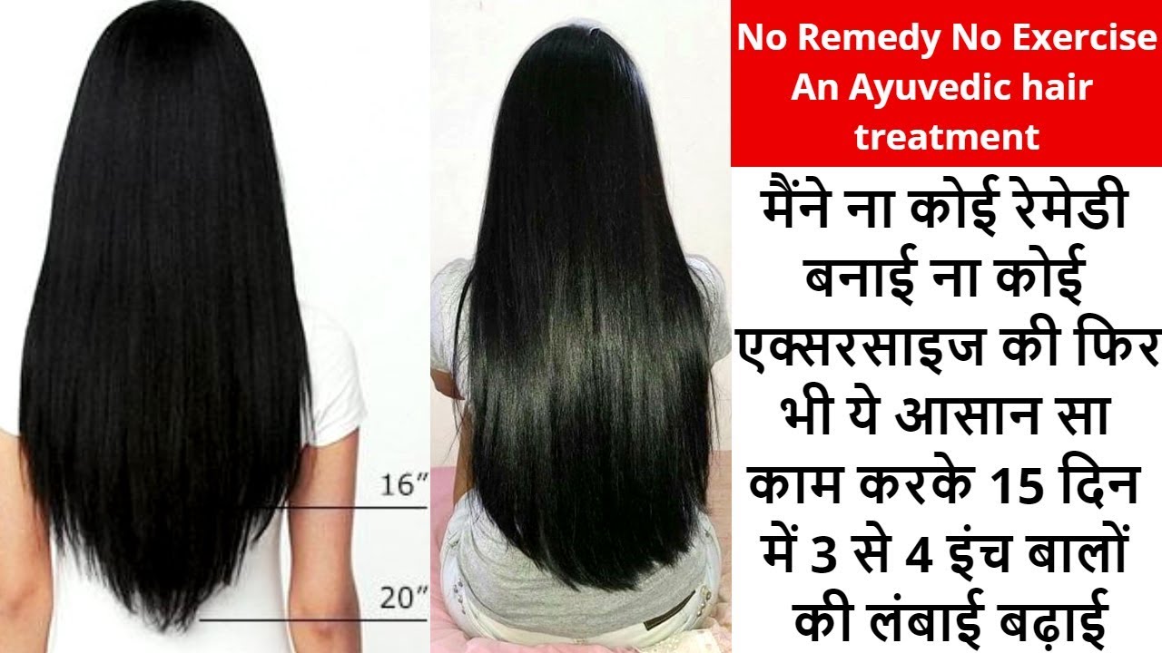 glowing skin captions 15 दिन में रोजाना ये लगा लो गंजे सर पर बाल आ जाएंगे शर्तिया 3 से 4 इंच बाल बढ़ाएं|Regrowth hair|