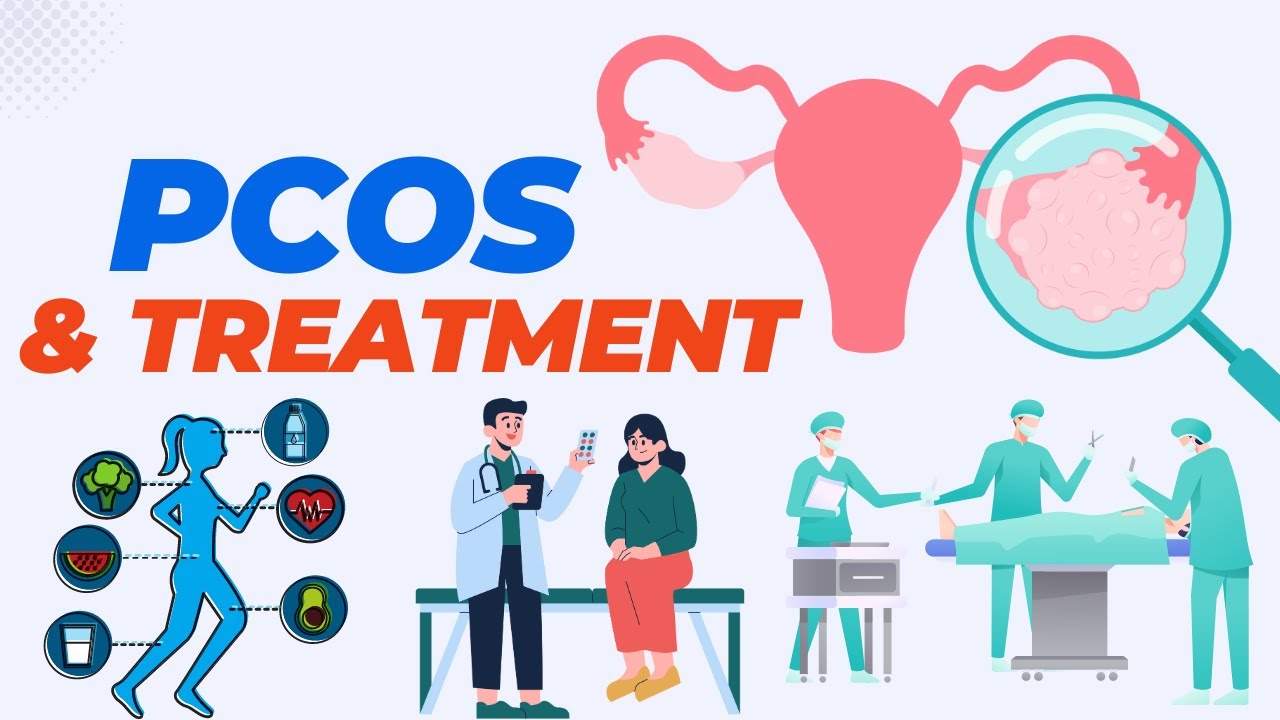 Curated visual reference: Polycystic Ovaries Treatment Your Guide To Managing Pcos Photo Inspiration