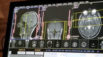 School of Medical Imaging MRI Lab - Cranial Nerves