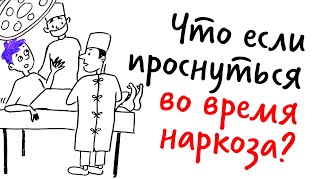 Что, если ПРОСНУТЬСЯ во время ОПЕРАЦИИ? - Научпок