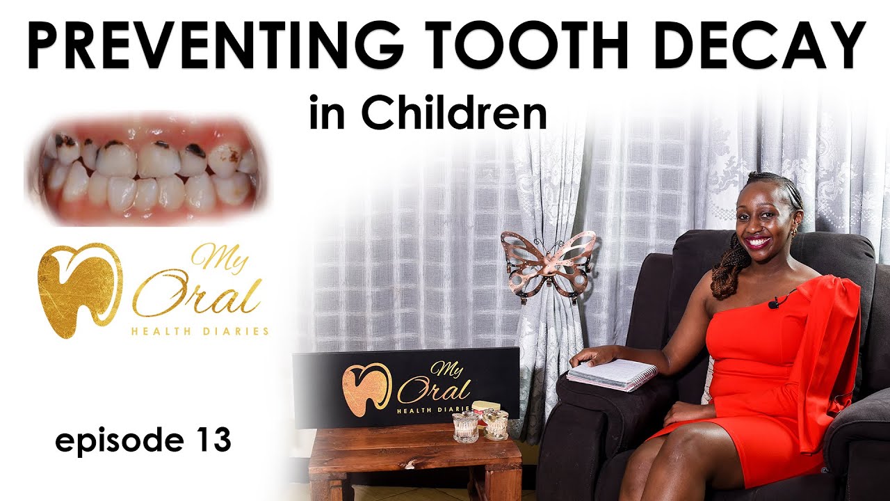 PREVENTING TOOTH DECAY IN CHILDREN