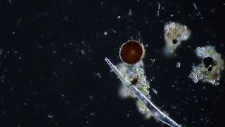 Arcella sp. (Testate amoeba) - Protozoans and other small critters