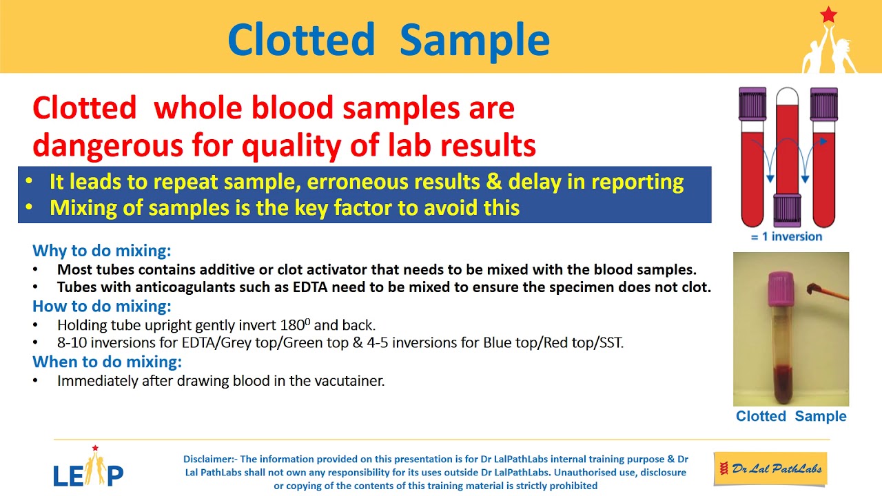 Clotted Sample YouTube