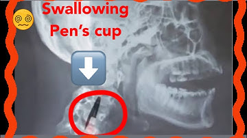 10 Everyday Things With Secret Purposes You Never Noticed!