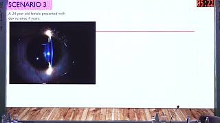 AIOC 2026   IC520   T Dr Anchal Thakur Ray Tracing Aberrometry itrace for Corneal and Lens based Ref