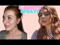 8 month nose job update   antonia higham