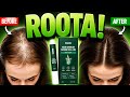 🇩🇪 Ich Verlor Mein Haar — Bis Ich Dieses Serum Fand | Roota Bewertung