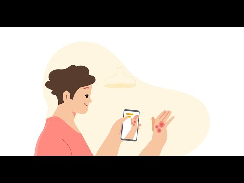 Skin Disease Detection System AI on Tensor flow / Keras and SckitLearn
