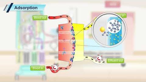 Prismaflex CRRT Transport Mechanism