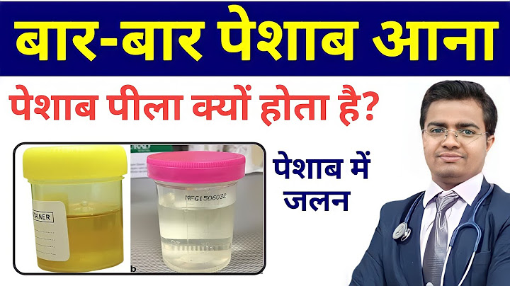 बार बार पेशाब आना | पेशाब में जलन | बार बार पेशाब आने के कारण और इलाज | bar bar peshab ana ki waja