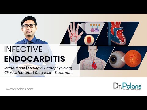 INFECTIVE ENDOCARDITIS - Etiology, Pathophysiology, Clinical Features, Management - (Animated)