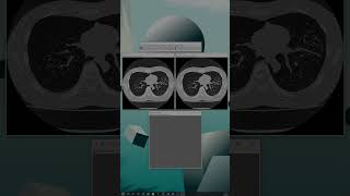 How to measure SNR* using ImageJ