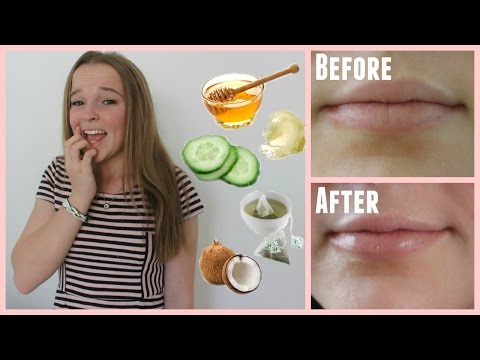 easy-ways-to-cure-chapped-lips-in-minutes!