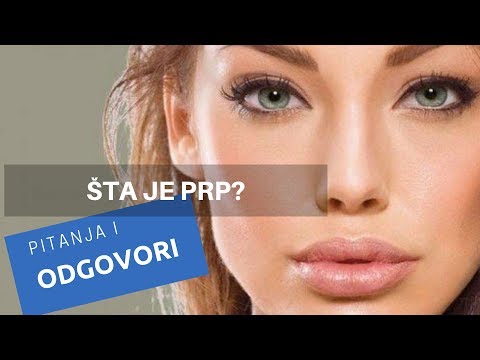 Šta je prp, plazma bogata trombocitima, pitanja i odgovori