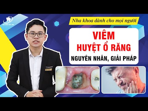 vệ sinh răng tại Kemtrinam.vn