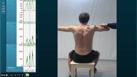 MR3 shoulder test with mobie and EMG