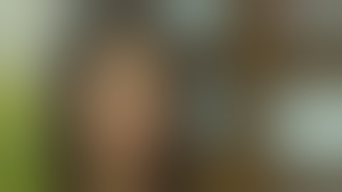 Nâng ngực có nguy hiểm không | Phẫu Thuật Nâng Ngực Đẹp Tự Nhiên