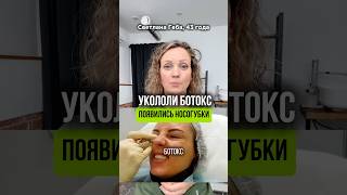 Откуда НОСОГУБКИ?🌱 #носогубныескладки #подтянутьовал #ототеков #фейсфитнес #геба #морщинылица