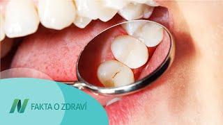 Erythritol vs. xylitol jako prevence zubního kazu
