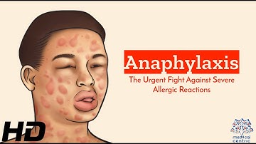 Anaphylaxis SOS: A Comprehensive Guide to Recognizing and Reacting