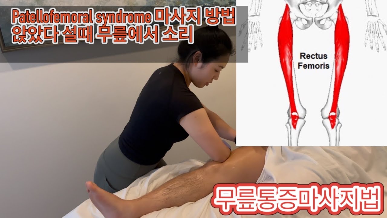슬개대퇴 통증 증후군 마사지 치료법 🇨🇦캐나다 마사지테라피스트가 알려주는 무릎 마사지 꿀팁 🍯앉았다 일어설때 무릎 소리 또는 젊은데 무릎 아프다면?? 꼭 시청하면 득이 되는 영상