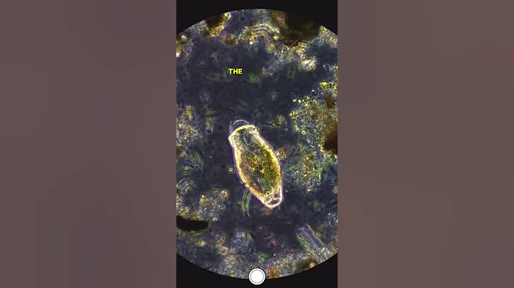 Microbe Disintegrates Under Microscope (Bleach VS Microbe) #microscope #microscopy #science