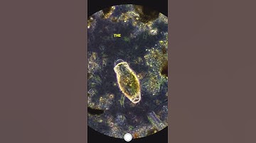 Microbe Disintegrates Under Microscope (Bleach VS Microbe) #microscope #microscopy #science