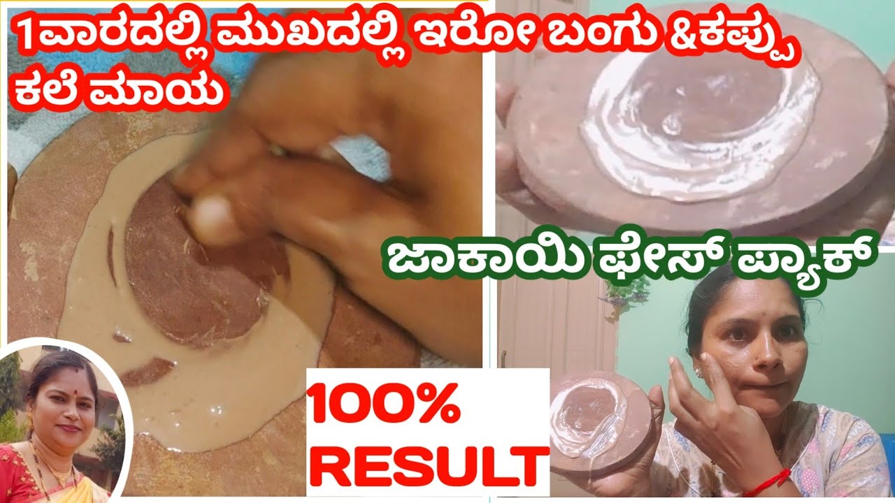 1ವಾರದಲ್ಲಿ ಈ ಜಾಕಾಯಿ ಫೇಸ್ ಪ್ಯಾಕ್ ಇಂದ ಮುಖದಲ್ಲಿನ ಬಂಗು& ಕಪ್ಪು ಕಲೆಗೆ ಹೇಳಿ  ಬೈ ಬೈ |durgaallinonechanal