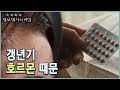 호르몬으로 인한 갱년기증후군의 증상과 치료 방법 (KBS 20221228 방송) Mp3 Song