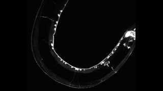 C. Elegans captured on a Revolution WD system