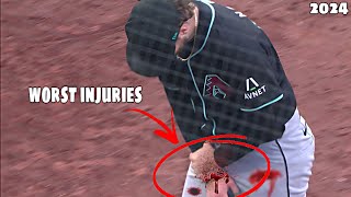 MLB• Worst Injuries of April 2024