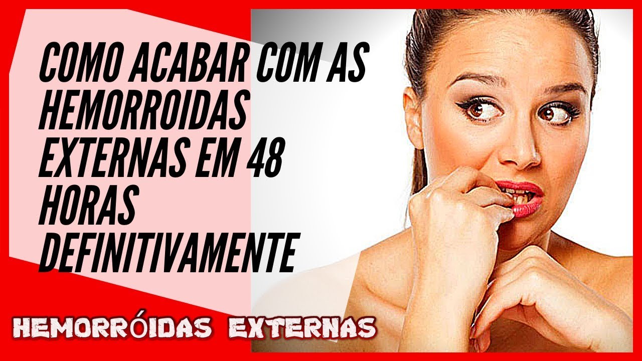 HEMORROIDAS EXTERNAS Saiba A Verdade De Como Acabar Com As 
