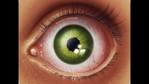 How to download showbox for your android device -