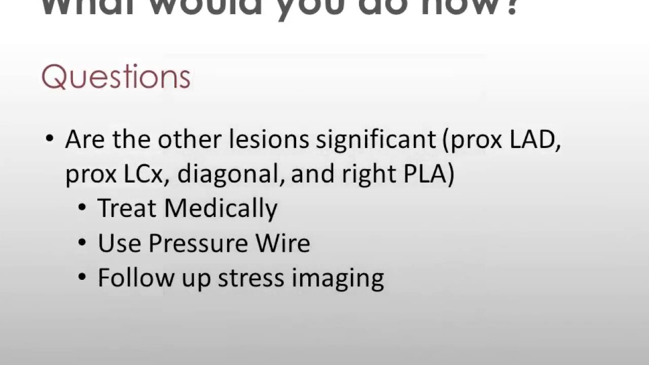 Using pressure wire to test nonculprit lesions during ACS YouTube
