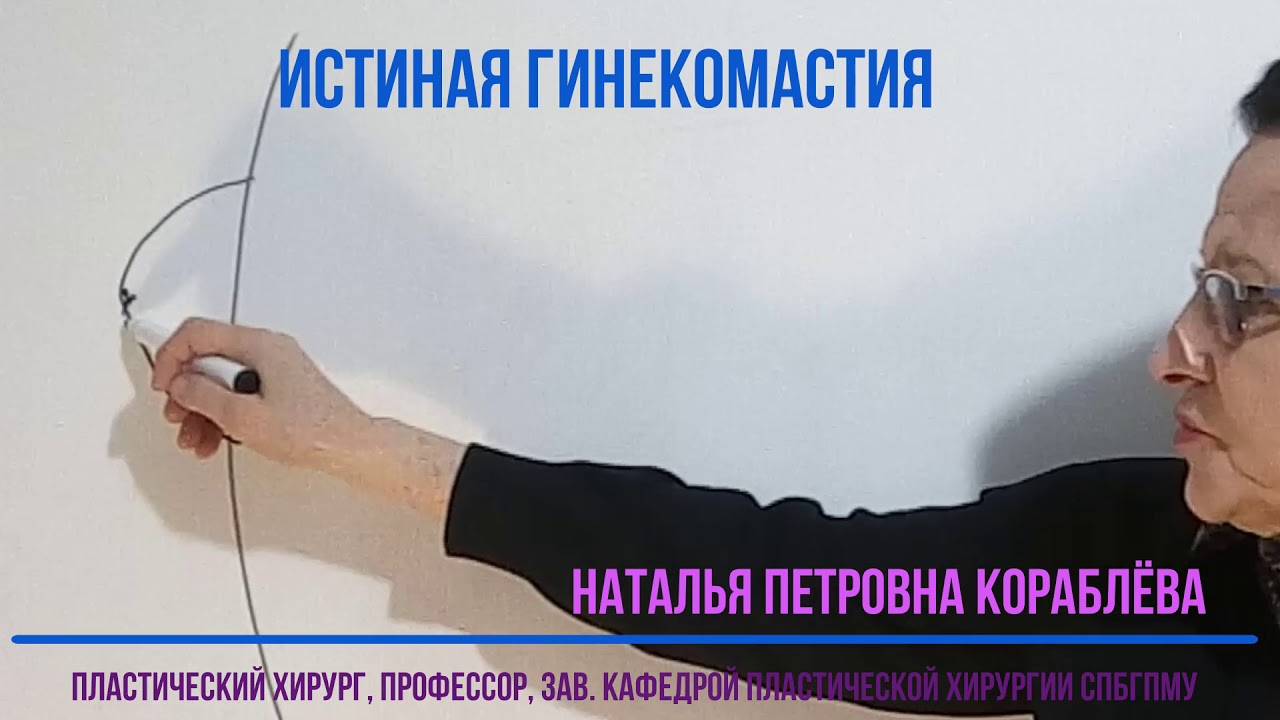 Истиная гинекомастия - YouTube