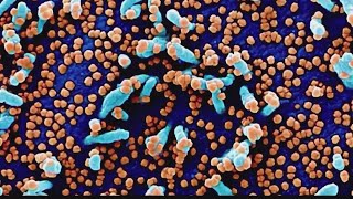 Virus fears trigger more holiday cancellations, restrictions
