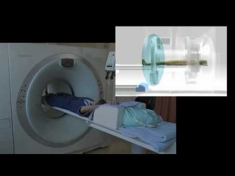 Video: PET-CT Trbuha: što će Pokazati Pregled