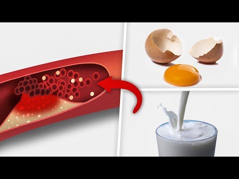 high-cholesterol-foods---5--high-cholesterol-foods-you-must-avoid
