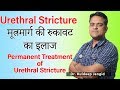   urethral stricture best permanent treatment  best homeopathy doctor in rajasthan