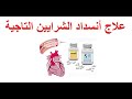 طرق علاج أنسداد الشرايين التاجية أو علاج ضيق الشرايين التاجية